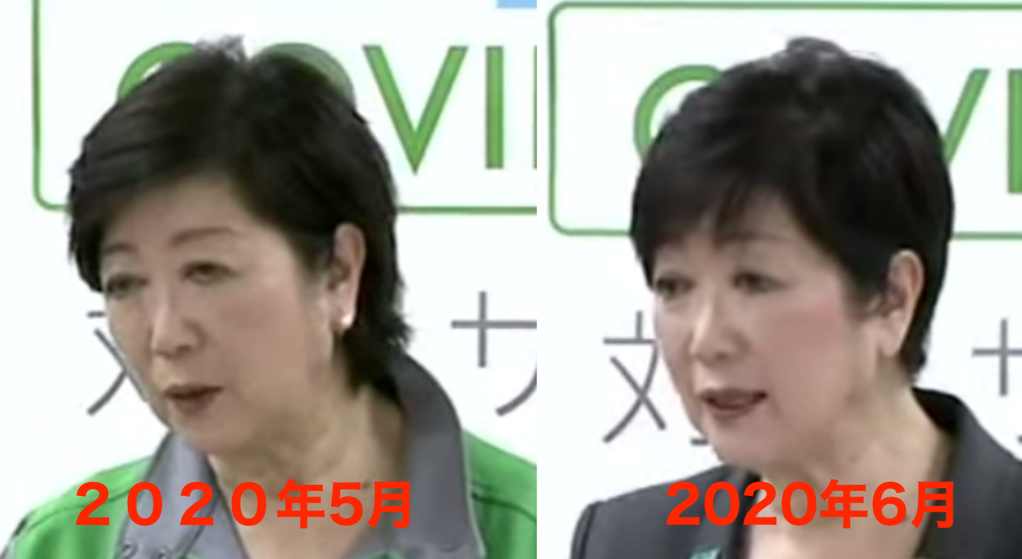 比較画像 小池百合子が痩せた理由は病気や疲労 大丈夫かと心配の声多数 Mayutre