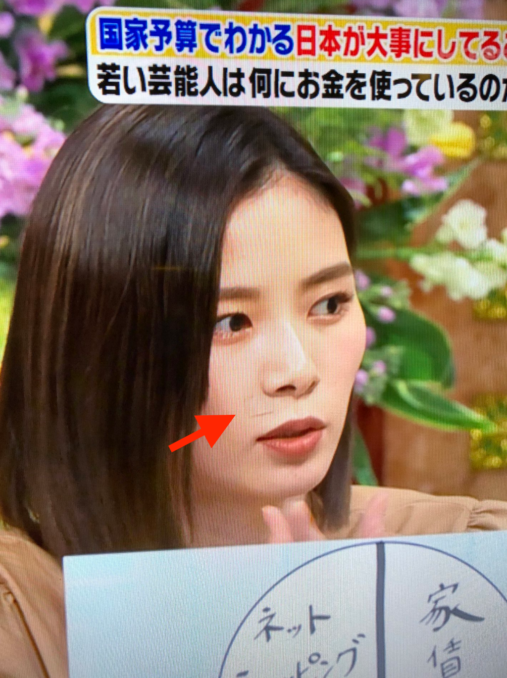 画像 朝日奈央がほくろ除去したのはいつ 取る前と後で比較 Mayutre